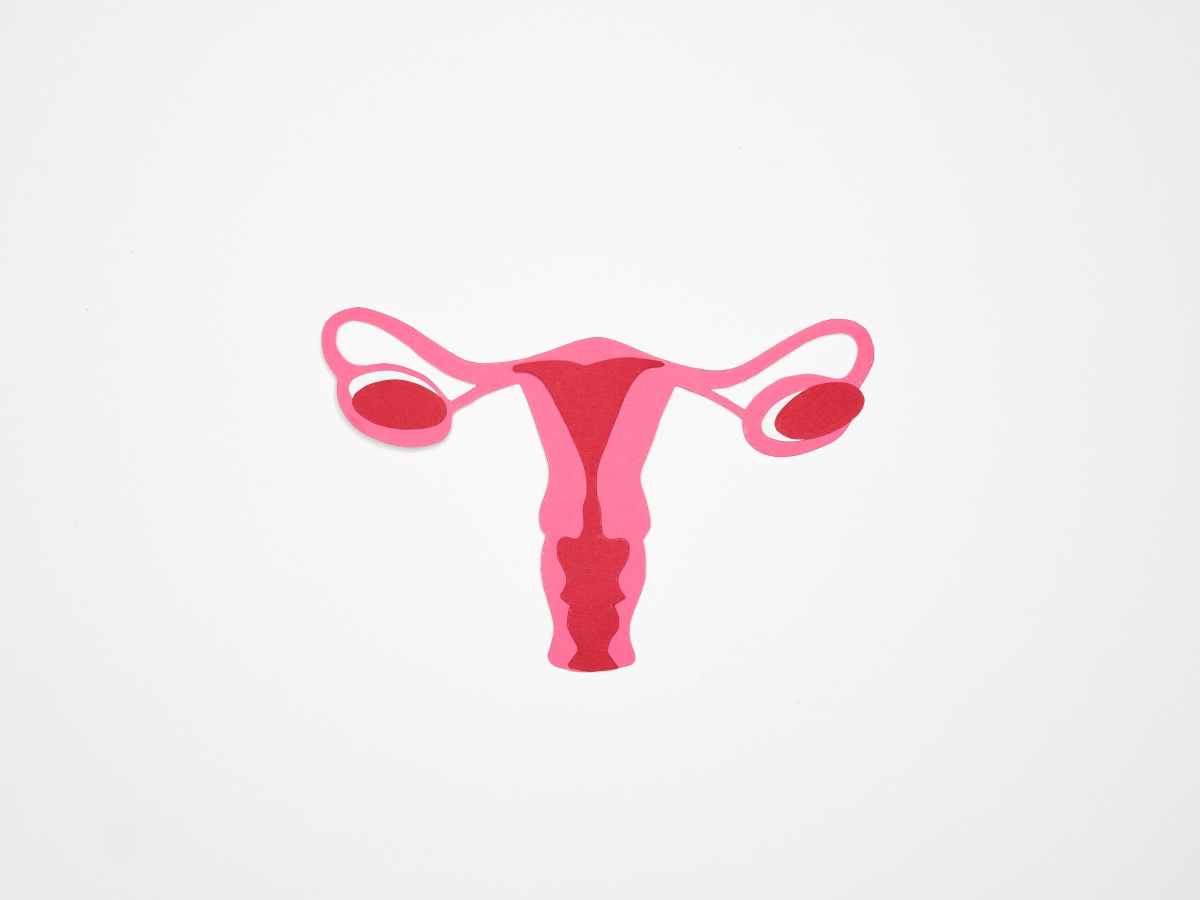 Preconception Diet for PCOS &&nbsp;Fertility